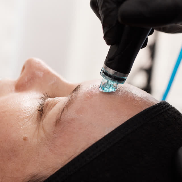 HydraFacial extraction step