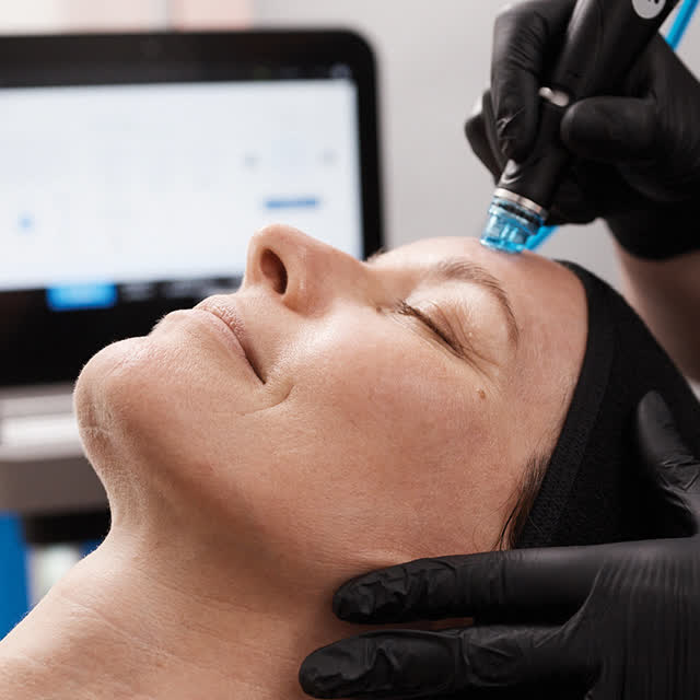 HydraFacial resurfacing step